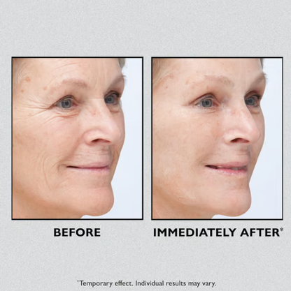 🔥Today 49% OFF🔥Temporary Face Tightener